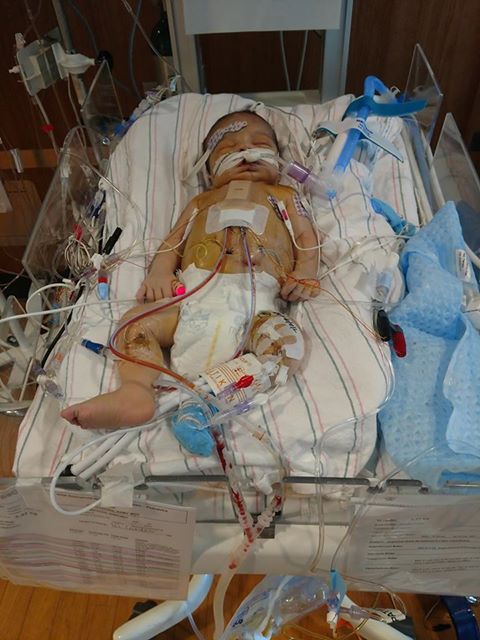 Reed after his first heart surgery. Source: Family photo